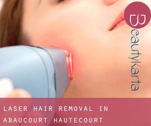 Laser Hair removal in Abaucourt-Hautecourt
