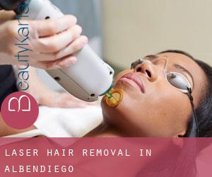 Laser Hair removal in Albendiego