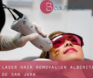 Laser Hair removal in Alberite de San Juan
