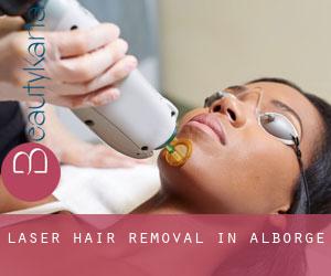 Laser Hair removal in Alborge