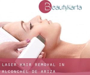 Laser Hair removal in Alconchel de Ariza