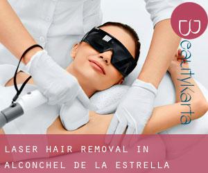 Laser Hair removal in Alconchel de la Estrella