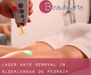Laser Hair removal in Aldealengua de Pedraza