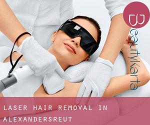 Laser Hair removal in Alexandersreut