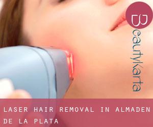Laser Hair removal in Almadén de la Plata