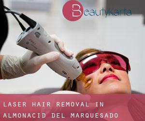 Laser Hair removal in Almonacid del Marquesado