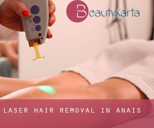 Laser Hair removal in Anais