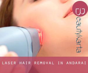 Laser Hair removal in Andaraí