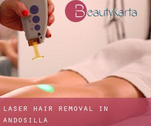 Laser Hair removal in Andosilla