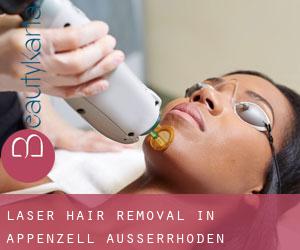 Laser Hair removal in Appenzell Ausserrhoden