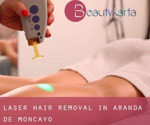 Laser Hair removal in Aranda de Moncayo