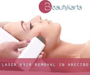 Laser Hair removal in Arecibo