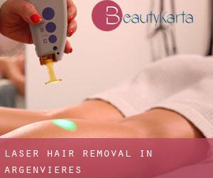 Laser Hair removal in Argenvières