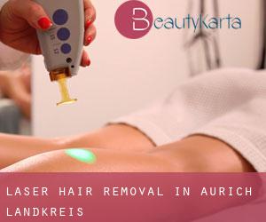 Laser Hair removal in Aurich Landkreis
