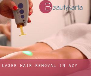 Laser Hair removal in Azy