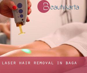 Laser Hair removal in Bagà