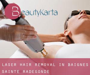 Laser Hair removal in Baignes-Sainte-Radegonde