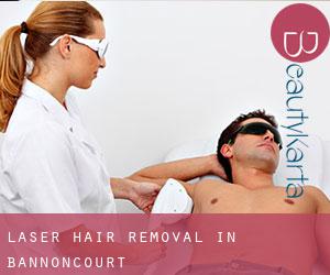 Laser Hair removal in Bannoncourt