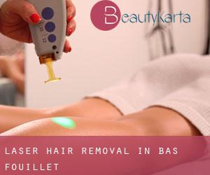 Laser Hair removal in Bas Fouillet