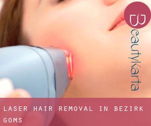 Laser Hair removal in Bezirk Goms