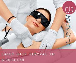 Laser Hair removal in Bidegoian
