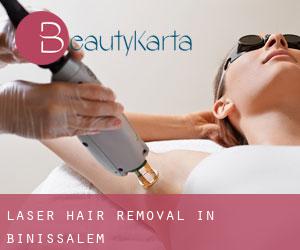 Laser Hair removal in Binissalem