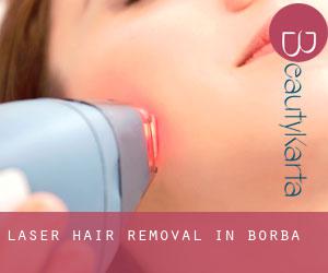 Laser Hair removal in Borba