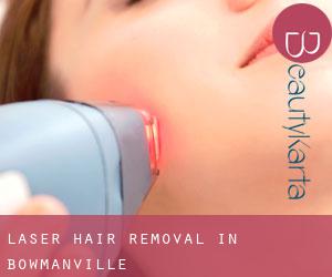 Laser Hair removal in Bowmanville