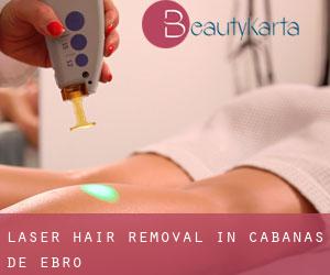 Laser Hair removal in Cabañas de Ebro