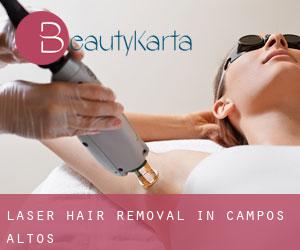 Laser Hair removal in Campos Altos