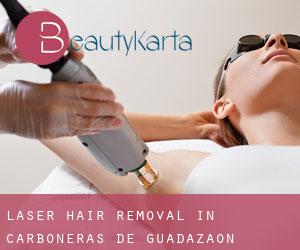 Laser Hair removal in Carboneras de Guadazaón