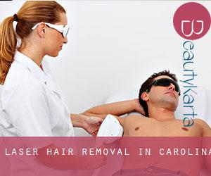 Laser Hair removal in Carolina