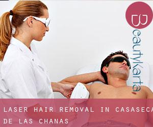 Laser Hair removal in Casaseca de las Chanas