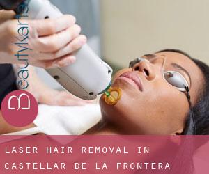 Laser Hair removal in Castellar de la Frontera