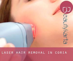 Laser Hair removal in Coria