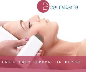 Laser Hair removal in Depere