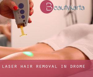 Laser Hair removal in Drôme
