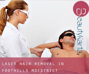 Laser Hair removal in Foothills M.District
