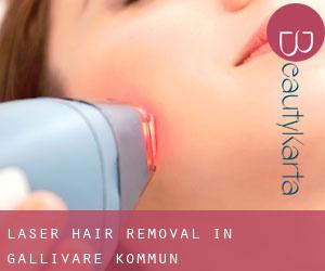 Laser Hair removal in Gällivare Kommun