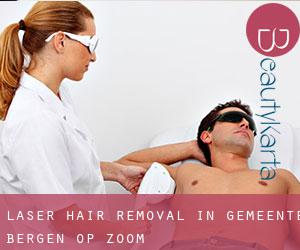 Laser Hair removal in Gemeente Bergen op Zoom