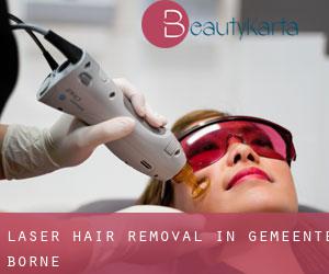 Laser Hair removal in Gemeente Borne