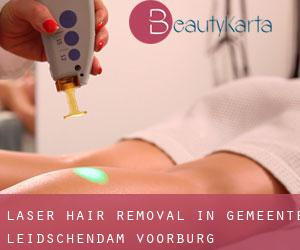 Laser Hair removal in Gemeente Leidschendam-Voorburg