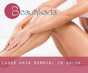 Laser Hair removal in Halsa