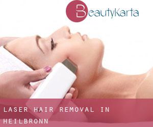 Laser Hair removal in Heilbronn Laser Hair removal in Heilbronn