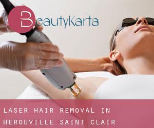 Laser Hair removal in Hérouville-Saint-Clair