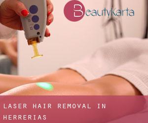 Laser Hair removal in Herrerías