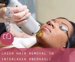 Laser Hair removal in Interlaken-Oberhasli