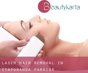 Laser Hair removal in Itaporanga (Paraíba)