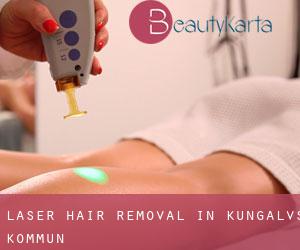 Laser Hair removal in Kungälvs Kommun