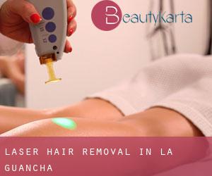Laser Hair removal in La Guancha